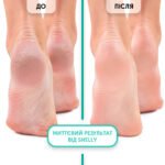 Schiuma express ammorbidente per pedicure Soft Blade Shelly 150 ml - immagine 4