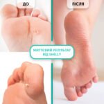 Gel cheratolitico per applicazione locale Soft Blade Shelly 100 ml - immagine 4